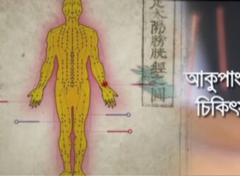 Health Program Acupuncture Treatment - ATN Bangla
