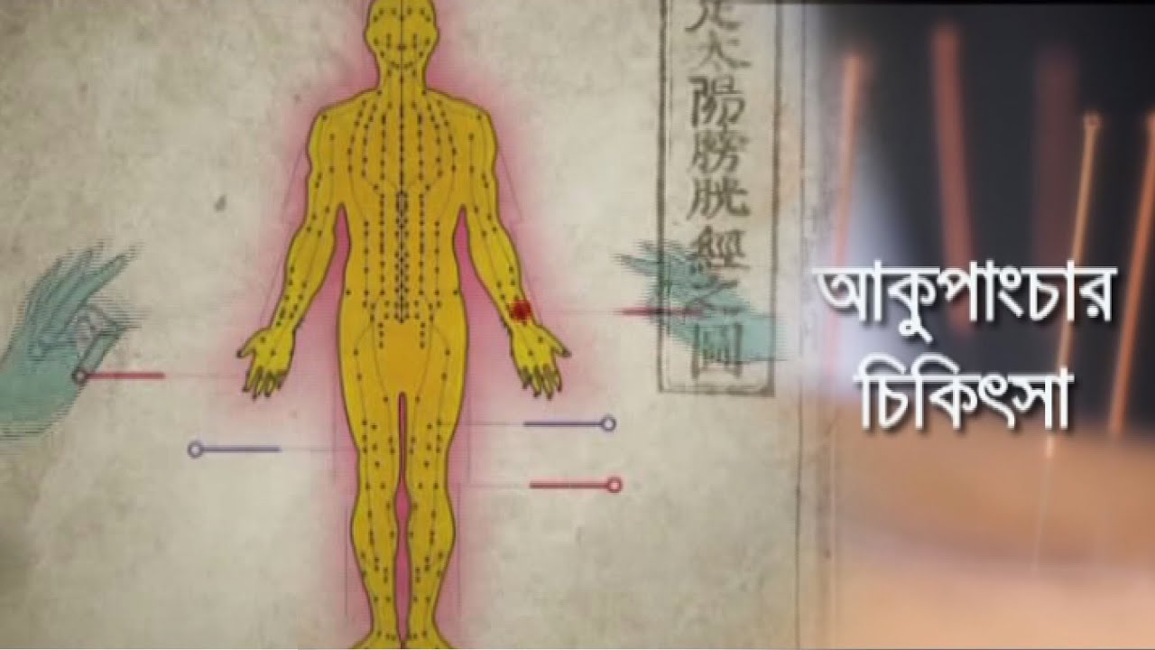 Health Program Acupuncture Treatment - ATN Bangla