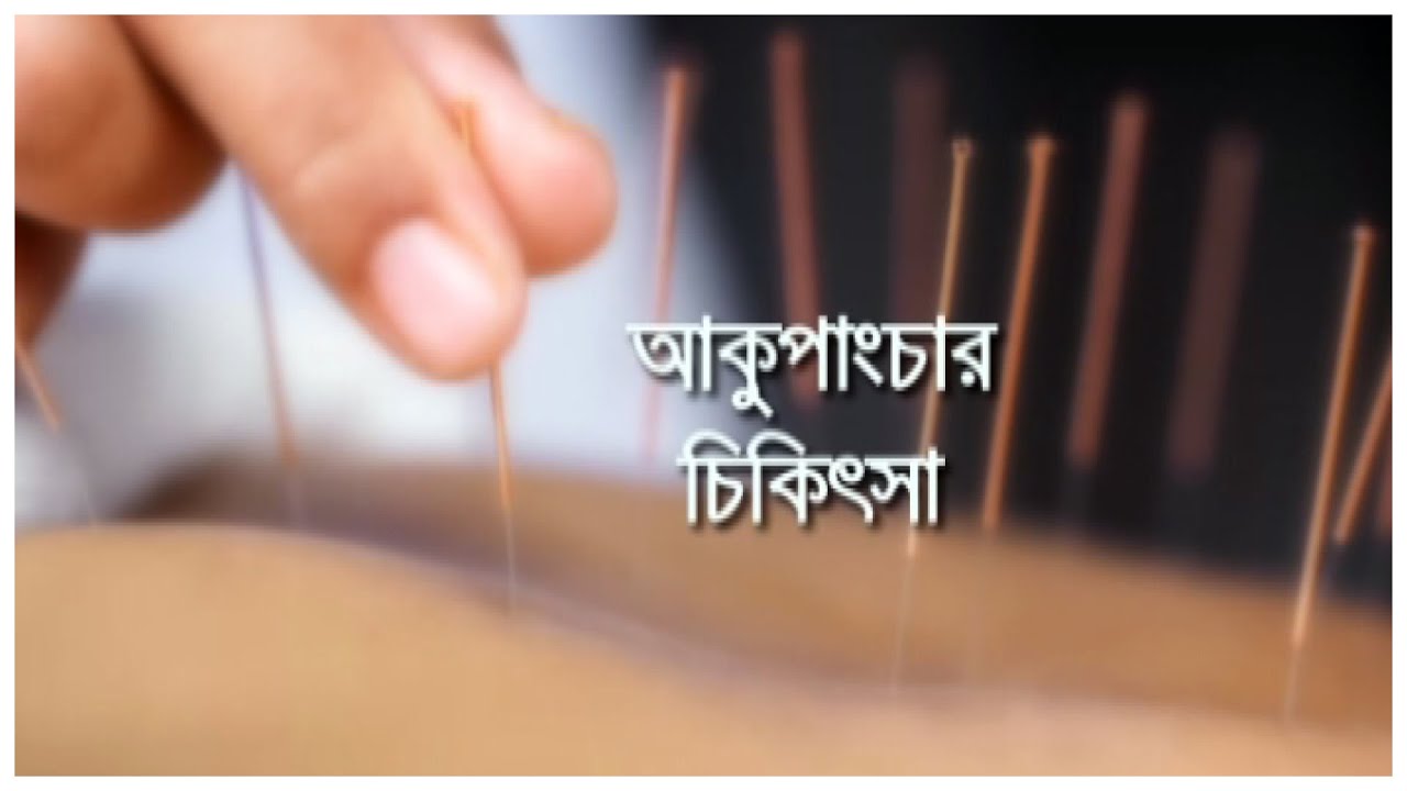 স্বাস্থ্য বিষয়ক অনুষ্ঠান ‍‍আকুপাংচার চিকিৎসা