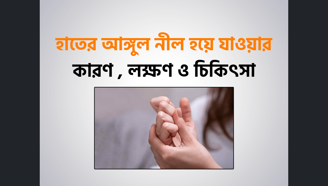 হাতের আঙ্গুল নীল হয়ে যাওয়ার (Raynaud Syndrome) কারণ , লক্ষণ এবং আকুপাংচার চিকিৎসা