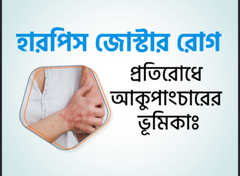 হারপিস জোস্টার ট্রিটমেন্ট, কারণ ও লক্ষণ "হারপিস জোস্টার ছবি "হারপিস জোস্টার কি ছোঁয়াচে "হারপিস জোস্টার "হারপিস জোস্টার এর ঘরোয়া চিকিৎসা হারপিস জোস্টার চিকিৎসা হারপিস জোস্টার কি ছোঁয়াচে রোগ হারপিস জোস্টার হোমিও চিকিৎসা হারপিস জোস্টার এর চিকিৎসা হারপিস জোস্টার হলে করণীয় হারপিস জোস্টার পিকচার্স হারপিস জোস্টার ভাইরাস কেন হয় হারপিস জোস্টার এর ঘরোয়া চিকিৎসা হারপিস জোস্টার ট্রিটমেন্ট হারপিস জোস্টার কি ছোঁয়াচে হারপিস জোস্টার লক্ষণ হারপিস জোস্টার ছবি হারপিস জোস্টার কতদিন থাকে হারপিস জোস্টার হলে করণীয়