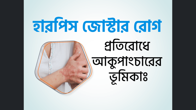হারপিস জোস্টার ট্রিটমেন্ট, কারণ ও লক্ষণ "হারপিস জোস্টার ছবি "হারপিস জোস্টার কি ছোঁয়াচে "হারপিস জোস্টার "হারপিস জোস্টার এর ঘরোয়া চিকিৎসা হারপিস জোস্টার চিকিৎসা হারপিস জোস্টার কি ছোঁয়াচে রোগ হারপিস জোস্টার হোমিও চিকিৎসা হারপিস জোস্টার এর চিকিৎসা হারপিস জোস্টার হলে করণীয় হারপিস জোস্টার পিকচার্স হারপিস জোস্টার ভাইরাস কেন হয় হারপিস জোস্টার এর ঘরোয়া চিকিৎসা হারপিস জোস্টার ট্রিটমেন্ট হারপিস জোস্টার কি ছোঁয়াচে হারপিস জোস্টার লক্ষণ হারপিস জোস্টার ছবি হারপিস জোস্টার কতদিন থাকে হারপিস জোস্টার হলে করণীয়