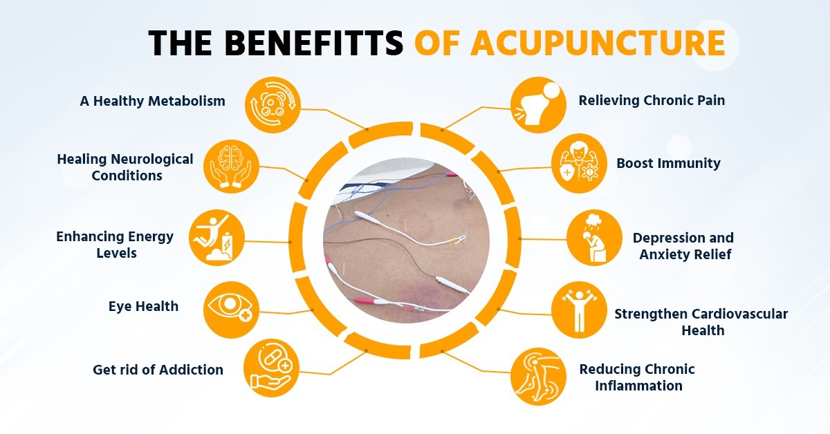 Top 20 Benefits of Acupuncture Treatment Top 20 Benefits of Acupuncture Treatment