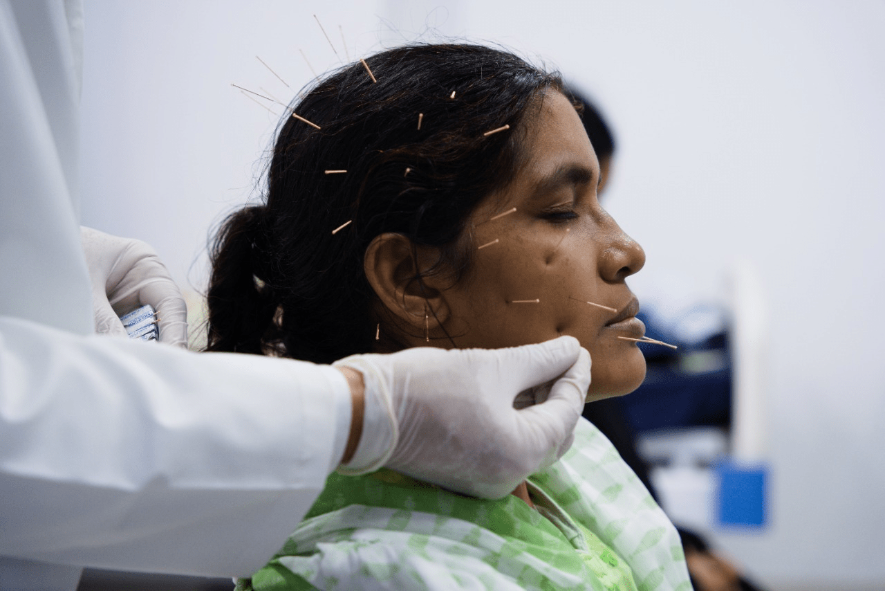 Facial Acupuncture for Neurological Well-being