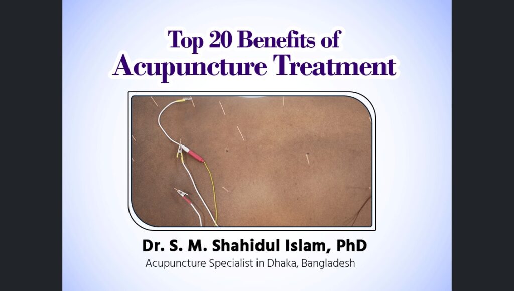 Top 20 Benefits of Acupuncture Treatment