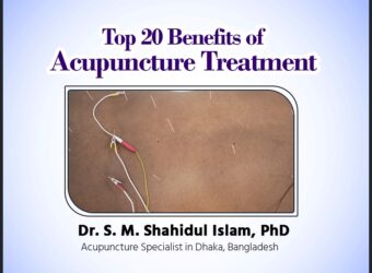 Top 20 Benefits of Acupuncture Treatment