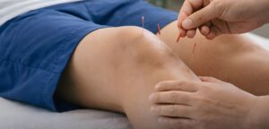 Acupuncture treatment for knee arthritis